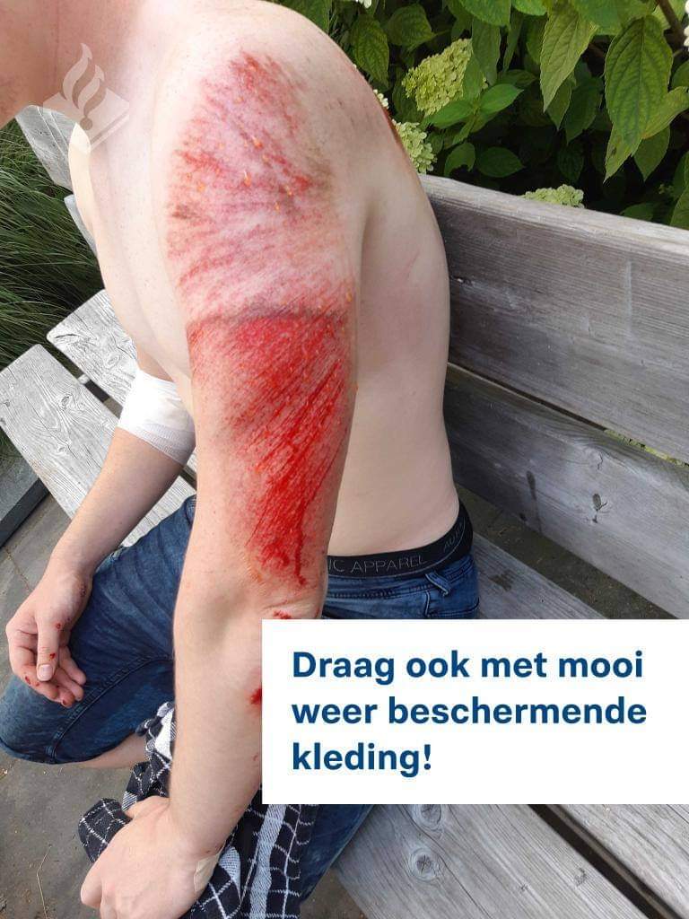Een foto van 3 jaar geleden maar nog steeds actueel. Dit was bij slechts 40 km/h. Aangezien het weer mooi weer wordt adviseren wij alle motorrijders BESCHERMENDE kleding te dragen.