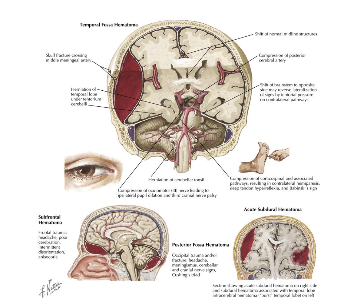 Oren Gottfried, MD tweet media