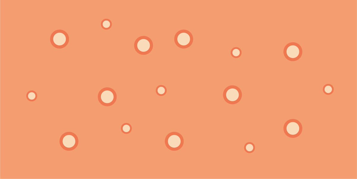 Statens Serum Institut har opdateret risikovurderingen for abekopper i Danmark.

ssi.dk/aktuelt/nyhede…