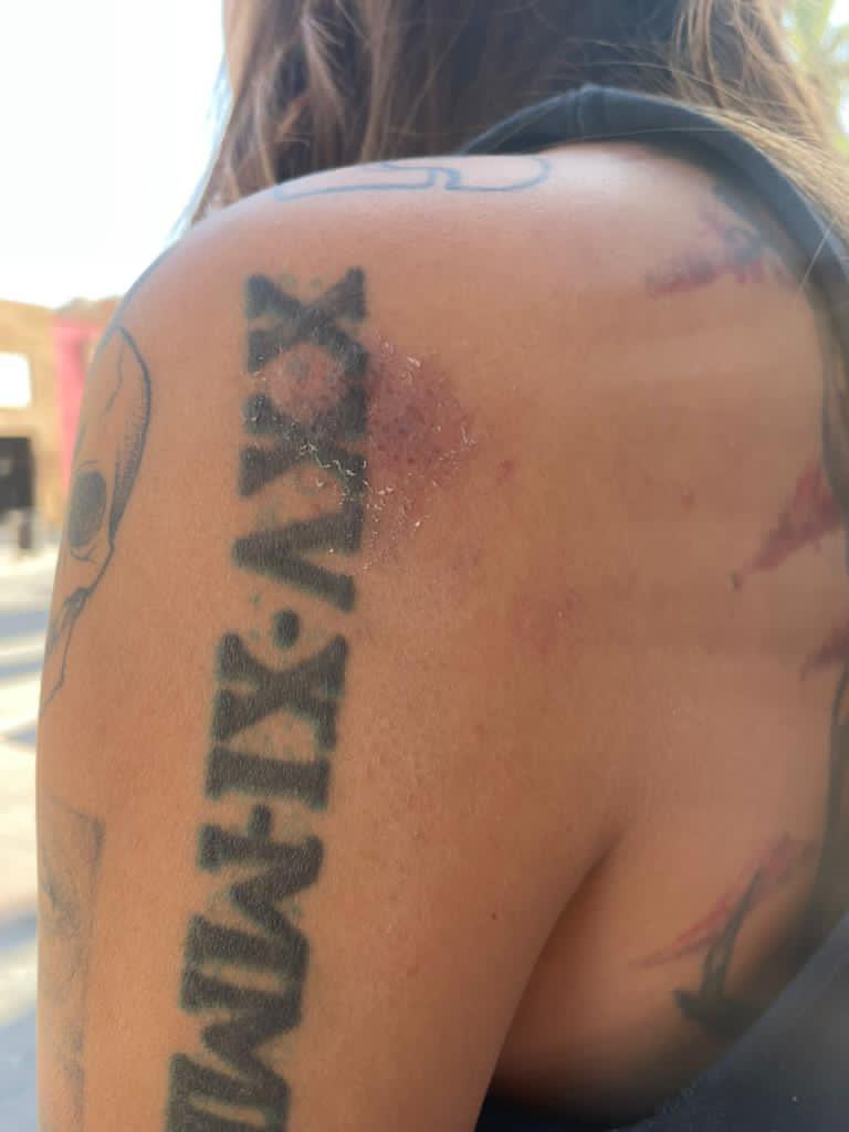 MarentisOficial's tweet photo. Hace 17 días mi ex pareja sin tener ya una relación conmigo, me quebró mi celular y me agredió físicamente.

!Aléjense de quién de señales de violencia!

Los gritos, las groserías, los celos, las desconfianzas, las mentiras no son amor…

No permitan ni 1 sola falta de respeto! https://t.co/SeD4fuHBGh