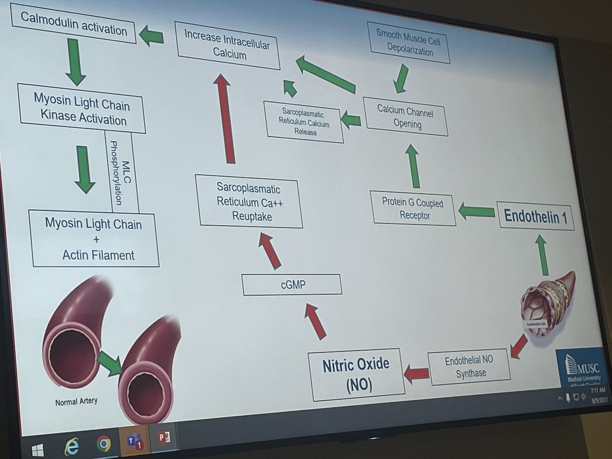 Alex Spiotta (@alex_spiotta) on Twitter photo Phenomenal grand rounds talk by <a href="/BrianSaway/">Brian Fabian Saway, M.D.</a> on vasospasm. Setting the bar high for the rest of residents ! <a href="/HolyCityNsgy/">MUSC Neurosurgery</a> <a href="/MUSCFoundation/">MUSC Foundation</a> Phenomenal grand rounds talk by <a href="/BrianSaway/">Brian Fabian Saway, M.D.</a> on vasospasm. Setting the bar high for the rest of residents ! <a href="/HolyCityNsgy/">MUSC Neurosurgery</a> <a href="/MUSCFoundation/">MUSC Foundation</a>