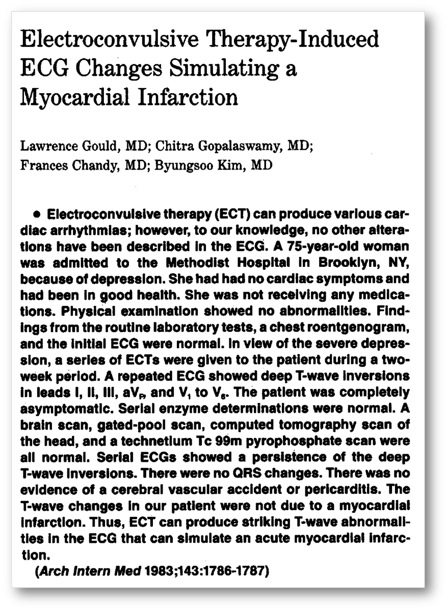 Ects Unexpected Success Rate Alleviating Depressions Grip - brqa1fq