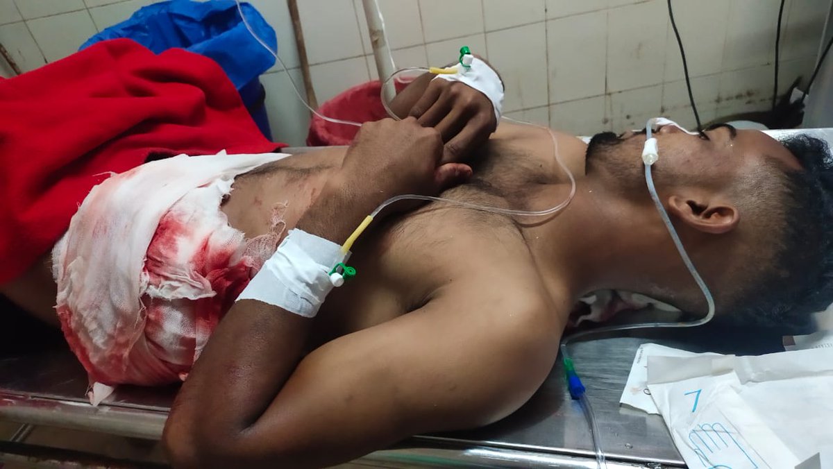 HateDetectors's tweet photo. Two youths #Touseef (23) and #Musthaq (24) has been stabbed allegedly by a #SriRamSene member #SomeshGudi during the #Moharram event at #Gadag district #Mallasamudra village tonight.

Touseef is said to be in critical condition. Somesh has been arrested.
#Karnataka https://t.co/XJpYBZdN1n
