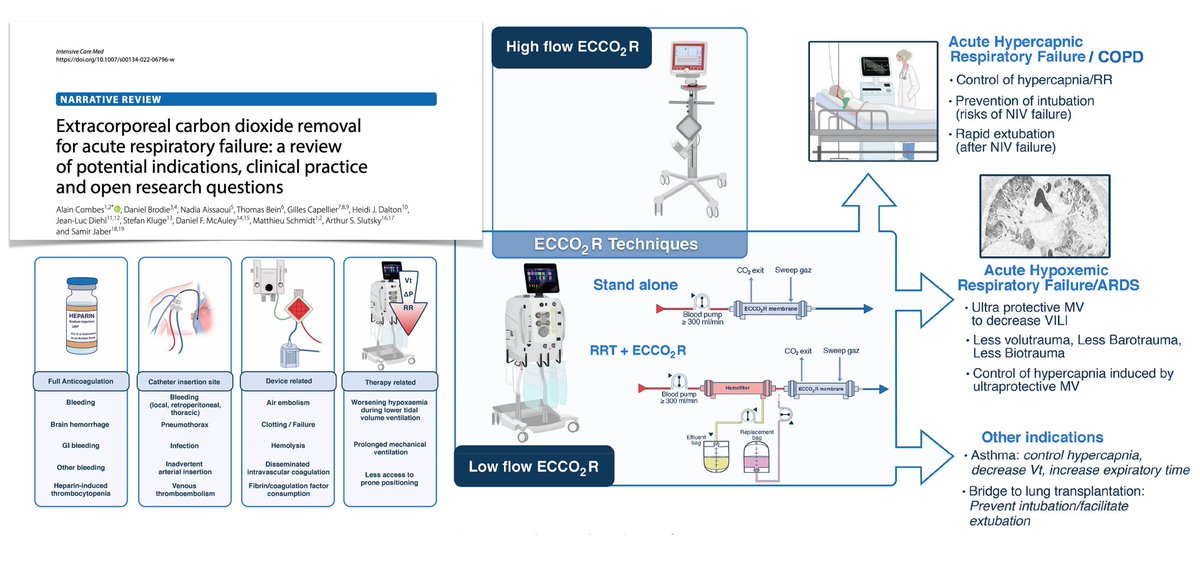 ECCO2R
➡️ what is it? definition, rationale, machines, materials & configurations
➡️potential indications: acute hypoxemic/hypercapnic resp failure
➡️ contraindications/non‑indications
➡️ management & associated complications
➡️ resources/costs
@yourICM
🖇️ bit.ly/3QaqZ9W