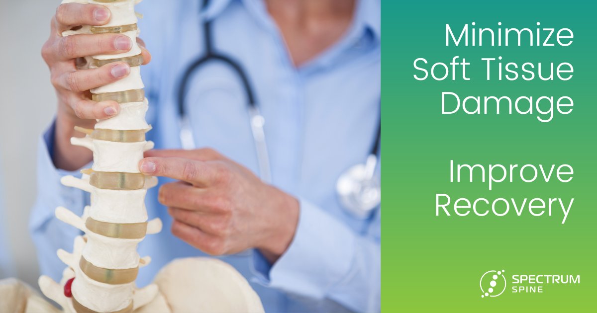 spctrmspine's tweet photo. Did you know Spectrum Spine offers spinal solutions that minimize soft tissue damage and give the body its best chance at recovery?

 Learn more about our spinal solutions at https://t.co/uoKsfWrhWH. #spinesurgeons #spinesurgery #medicaltechnology https://t.co/OAICJxiugu
