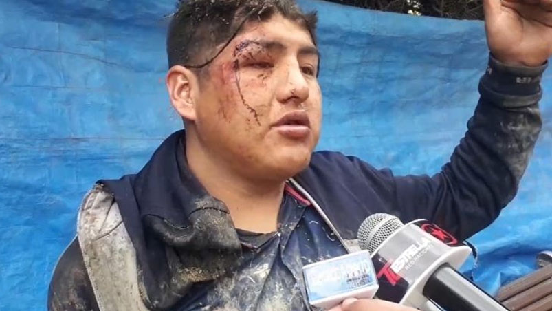 Fue a la fiesta de la Pachamama, se emborrachó y lo enterraron vivo como ofrenda >> eldoce.tv/mundo/fue-fies…