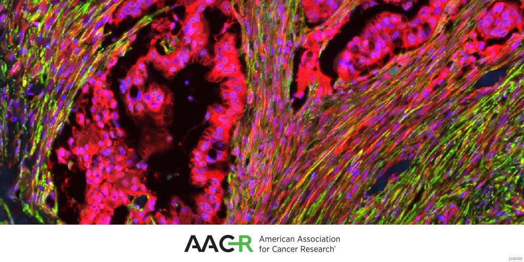 Cancer Research (@cr_aacr) on Twitter photo Check out Cancer Research's newest collection, Targeting the Tumor Microenvironment: bit.ly/3djy2yq Check out Cancer Research's newest collection, Targeting the Tumor Microenvironment: bit.ly/3djy2yq