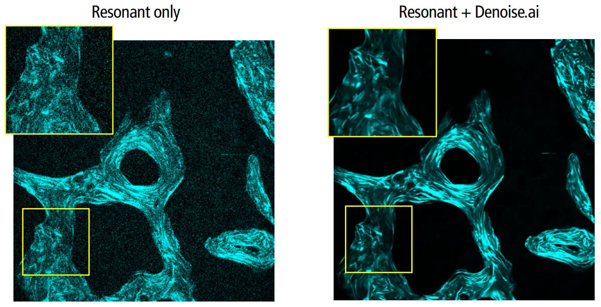 Check out our #AppNote demonstrating use of our AX R MP #Multiphoton #Microscopy system for second harmonic generation #SHG #Imaging of bone collagen fibers as part of a study into the pharmacological effects of the osteoporosis drug teriparatide: bit.ly/3bCA3FL