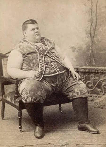 World’s fattest man in 1890 was large enough to be considered a “freak show” in the circus.