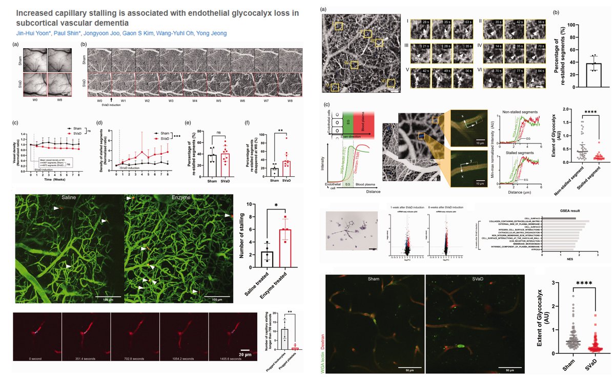 #CapillaryStalling caused by #EndothelialCell #Glycocalyx attrition

#OpticalCoherenceTomography+2PM

Heparinase+Hyaluronidase, or🐭#VascularDementia induced by Zoletil+xylazine i.p

Mainly Leukocyte plugging

Dr Wang-Yuhl Oh &amp; Yong Jeong labs <a href="/_JCBFM/">JCBFM</a> 2022
journals.sagepub.com/doi/10.1177/02…