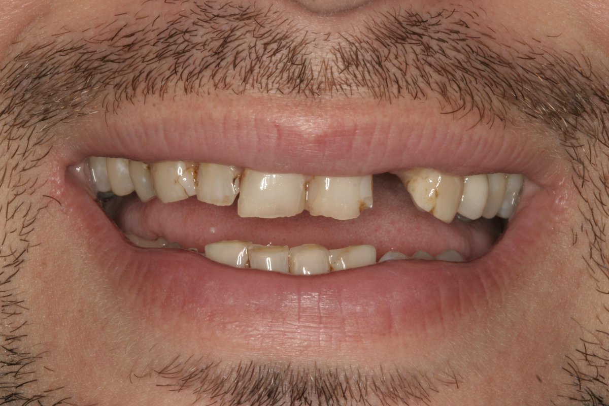 PrimeDENTAL's tweet photo. The amazing transformation of one of our very happy patients! What is stopping you from obtaining your dream smile? https://t.co/l3Ddlodn0y