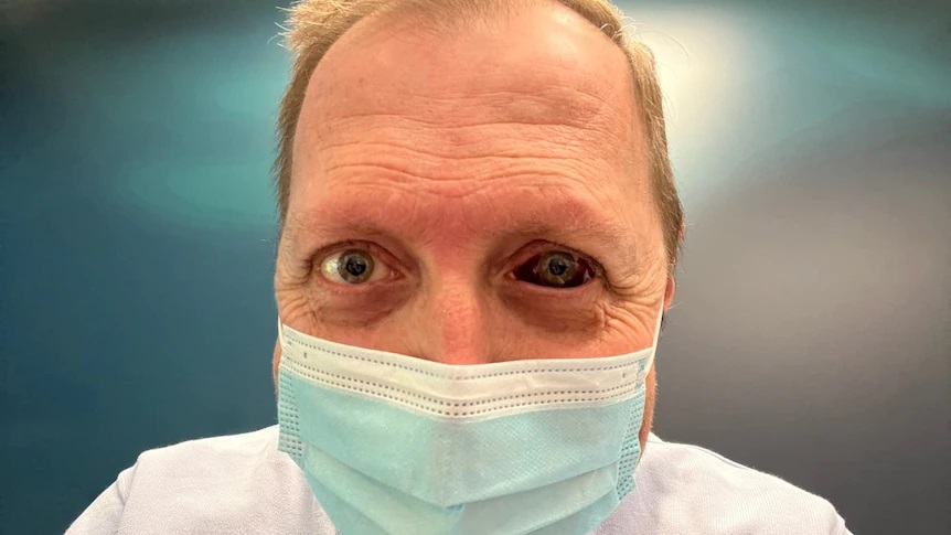 ABCNerdzilla's tweet image. Yes that is @JoelRheinberger going viral for his freaky eye!

abc.net.au/news/2022-08-0…