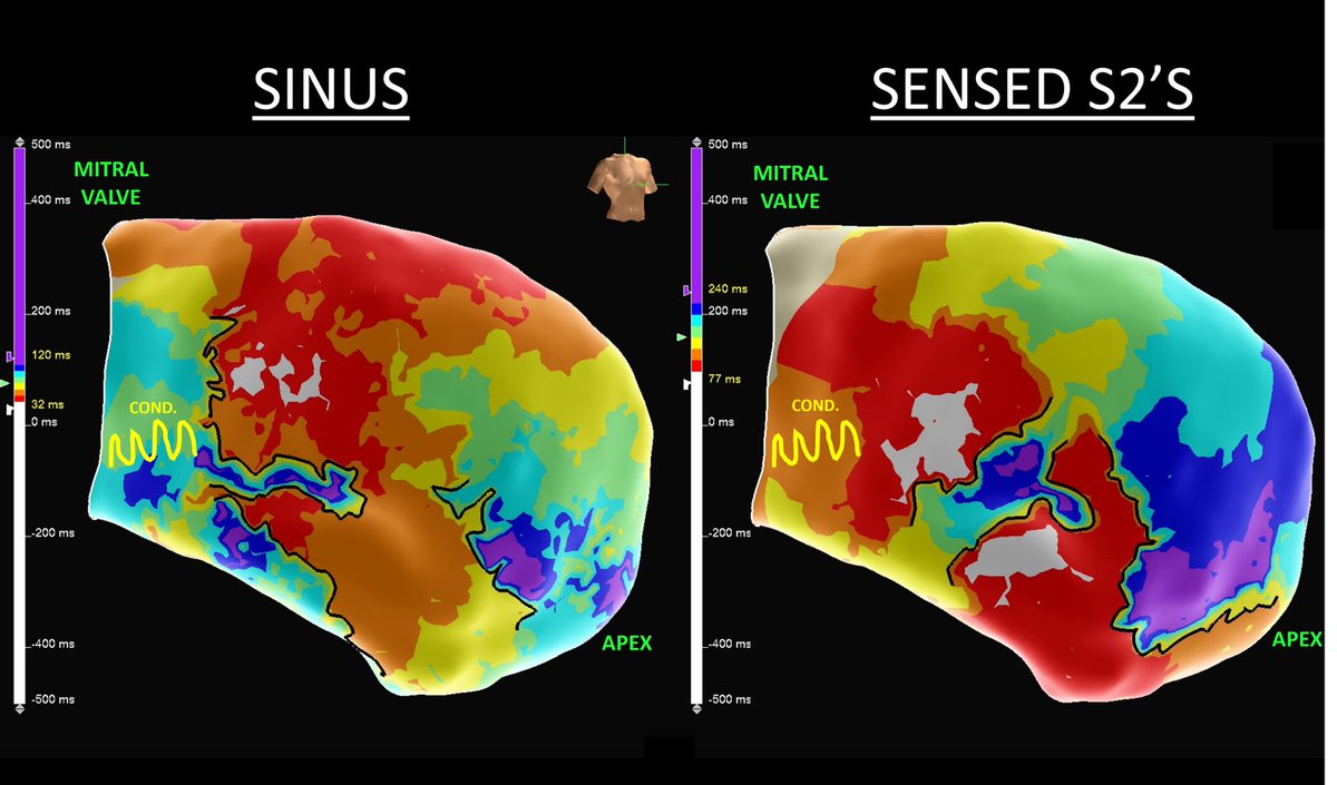 W2 Mappers tweet media