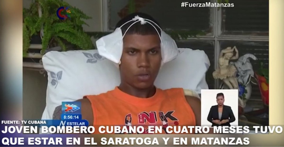 PstorAdrianPose's tweet photo. Así trata nuestra revolución socialista a nuestros héroes. Con par de nasobucos en las orejas para protección de infección de quemadura. Gracias por todo Canel! https://t.co/gVf7xTr4hk