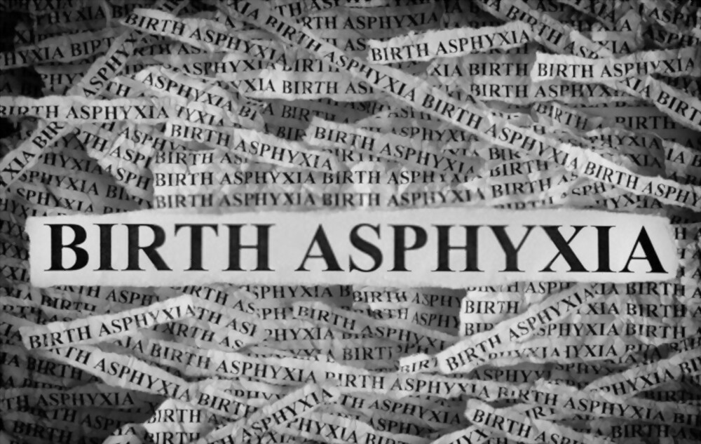 #Birthasphyxia happens when a #baby #brain  and other #organs do not get enough #oxygen  and #nutrients before, during or right after #birth ; it results into a #disorder known as #BirthAsphyxia.
For details:-neonatology.pediatricsconferences.org
 #Neonatology 2022 #Conference #Pediatrics