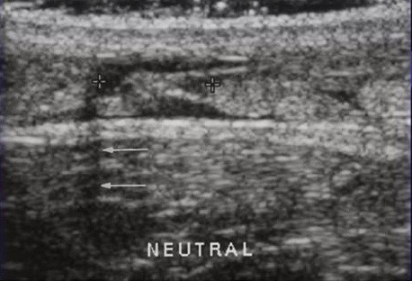We work with some of the best radiologists in the business to help deliver patients the highest quality care. Our network of providers is vast and we will always endeavour to help our patients receive a hassle free experience.  Read more: totalorthopaedics.london