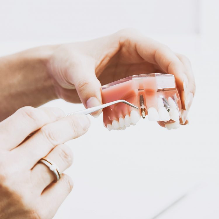 Problems with dentures include the fact that patients are not used to having something in their mouth that is not food and the Dental Implant Dentist Rockford help on it. The brain senses this appliance as "food" and sends messages to the salivary glands to produce more saliva.