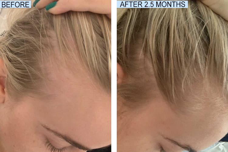 weightft's tweet image. FULLY VITAL HAIR GROWTH SYSTEM

This 100% natural hair system works from the inside out and outside in.

CLICK HERE TO ORDER OR TO LEARN MORE: bit.ly/FullyVito

#hairgrowth #hair #haircare #naturalhair #healthyhair #hairgoals #hairloss #hairstyles #beauty #curlyhair