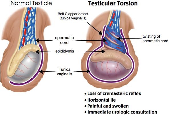 Blue Balls Condition