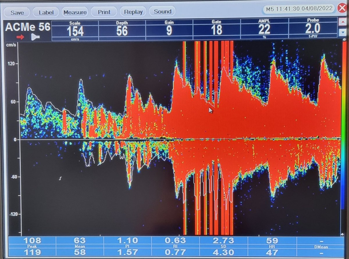Neurosonology Lab - LHC tweet media