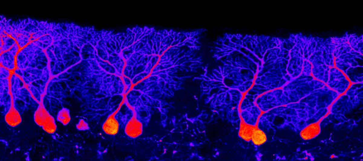 #SciencePhoto_IN
"The Purkinje's Forest"
Author: Dr. Abraham Andreu <a href="/EsticNegre/">Abranett</a>
Lab: Dr. Salvador Martínez <a href="/SalvaMP1961/">Salvador Martinez</a>
Dr. Eduardo de Puelles <a href="/edepuelles/">Eduardo de Puelles</a>  
Dr. Diego Echevarría <a href="/DEchevarria_Aza/">Diego Echevarria</a>
"Purkinje cells of the cerebellum in fire colors. Imaged with <a href="/LeicaMicro/">Leica Microsystems</a> SPEII."