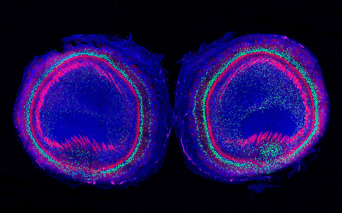 #SciencePhoto_IN
"The sight of the olftatory bulb"
Author: Dra. Verónica Company @VeritoOoO
Lab: Dr. Salvador Martínez <a href="/SalvaMP1961/">Salvador Martinez</a>
Dr. Eduardo de Puelles <a href="/edepuelles/">Eduardo de Puelles</a>  
Dr. Diego Echevarría
"3 days mouse olfactory bulb: Eomes (green) and cytoplasm (red). <a href="/LeicaMicro/">Leica Microsystems</a> SPEII."