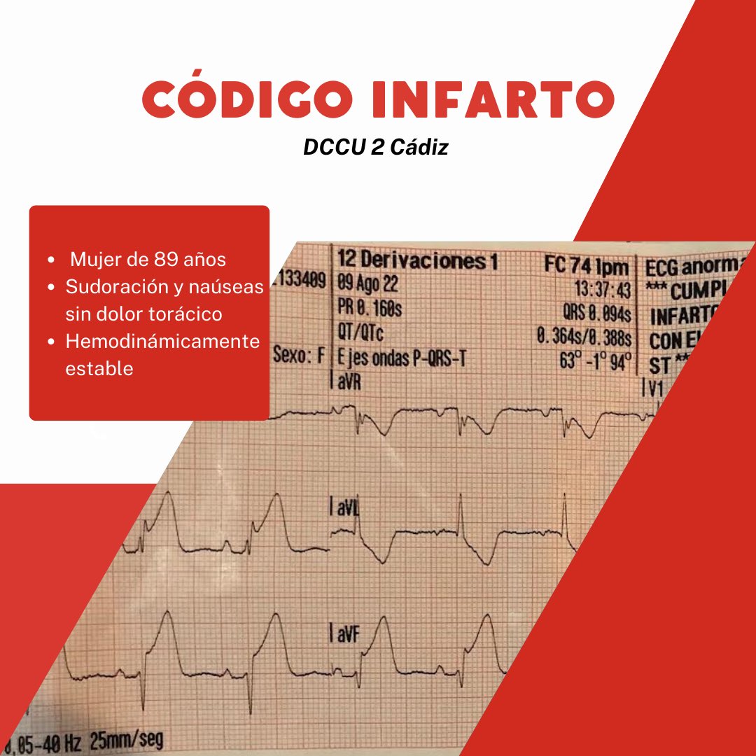 extrahosp_plat's tweet photo. #SCACEST con clínica atípica con traslado a hemodinámica. A diario tratamos con patologías tiempo dependientes en los que la rapidez en el diagnóstico y la coordinación con el resto de servicios es esencial.
#infarto #MismasFuncionesMismasCondiciones #MareaAzul https://t.co/Ws7BXKLcyE