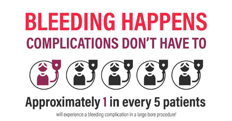 Approximately 1 in every 5 patients will experience a bleeding complication during a large bore procedure. The Early Bird Bleed Monitoring System can detect a bleed early, before it becomes a complication. Learn more at saranas.com #CardioTwitter