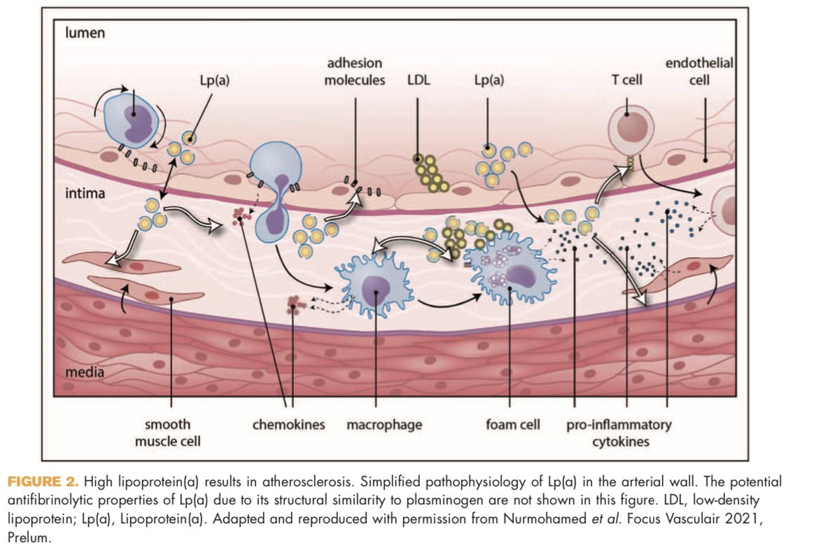 Considerations for routinely testing for high Lp(a) doi.org/10.1097/mol.00…