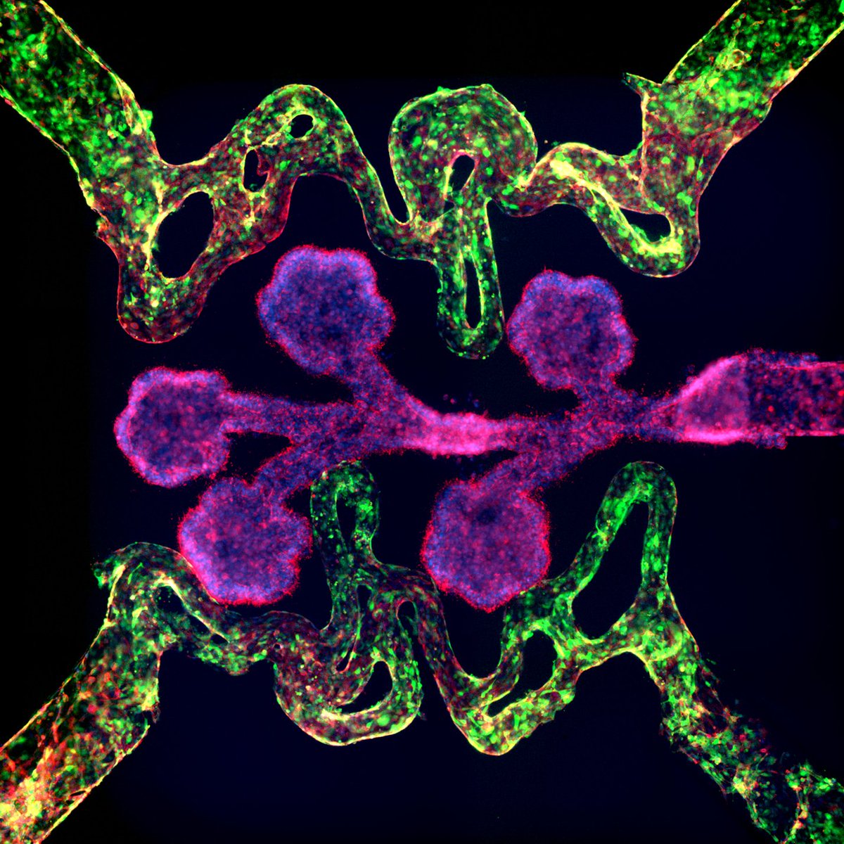 CalmMcmaster's tweet photo. The 2nd place prize of our C2Discover Microscopy Competition goes to Shravanthi Rajasekar (@shravr07 @BZhangLab) with a stunning image of Lung Alveoli on a Chip! The engineered lung alveoli (red) can be seen intertwining with blood vessels (green) in an organ-on-chip platform. https://t.co/4rJpAaWDyt