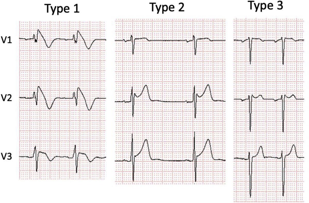 Are you ready for a case challenge?
#dizziness#syncope#sports
ow.ly/JMtc50KgfHr