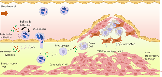 Portland Press (@pppublishing) on Twitter photo What can non-coding RNA reveal about disease progression, and are they a potential therapeutic target? Vartak et al. at the <a href="/UCDDCRC/">UCD Diabetes Complications Research Centre</a> delve into the role of miRNA in the development & progression of atherosclerosis, as well as potential therapies #BiosciRep doi.org/10.1042/BSR202… What can non-coding RNA reveal about disease progression, and are they a potential therapeutic target? Vartak et al. at the <a href="/UCDDCRC/">UCD Diabetes Complications Research Centre</a> delve into the role of miRNA in the development & progression of atherosclerosis, as well as potential therapies #BiosciRep doi.org/10.1042/BSR202…