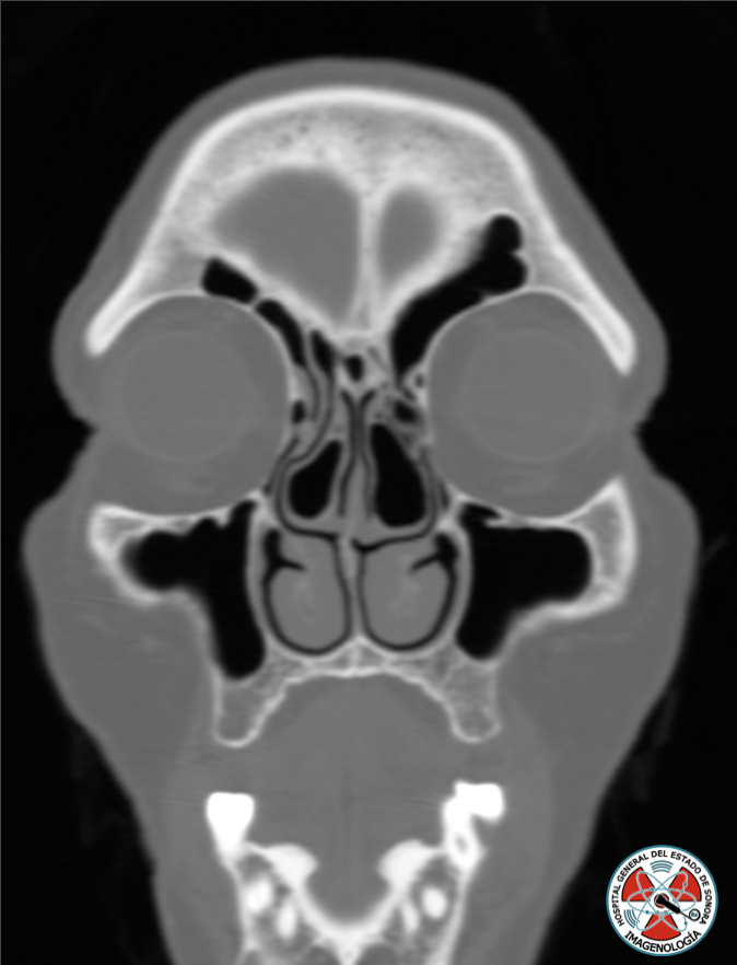 ¿Cual es tu impresion diagnositca? #radres#radiology#RX