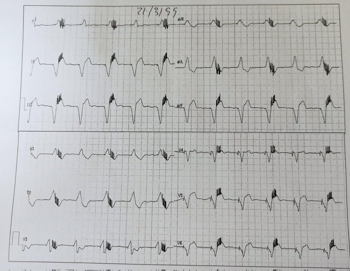 Cardio-Primaria Ferrol tweet media