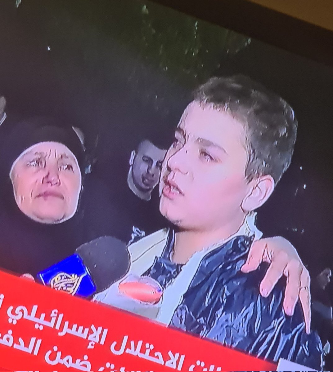 Palestinian child Muhammad Nazzal, just freed from Israeli prison, tells Al Jazeera that his arm was broken due to Israeli jailers' torture last week. He added that before his release, Israeli jailers beat him again today and did not provide him medical treatment.

A child.