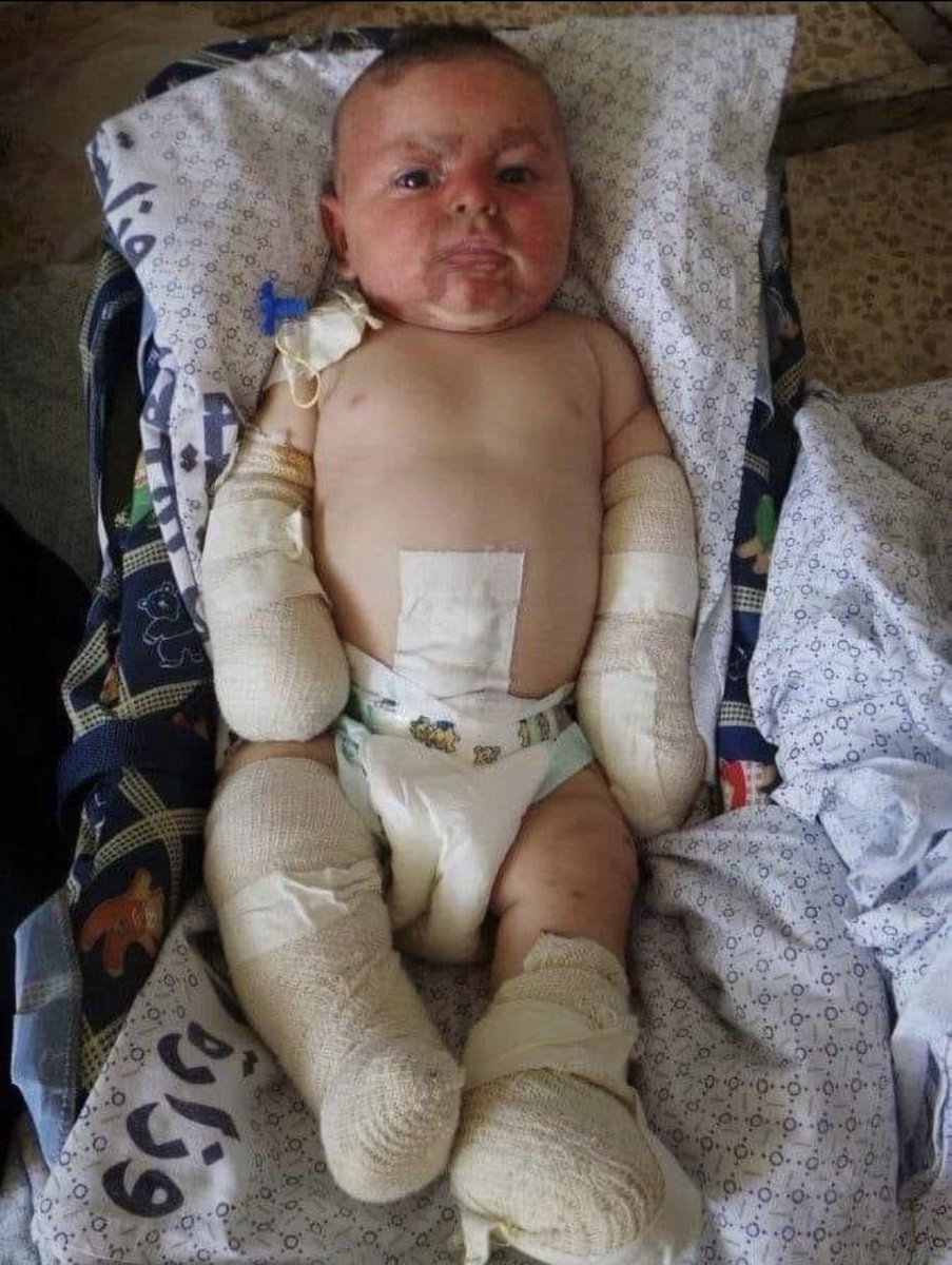 What Israelis do to Palestinian babies.