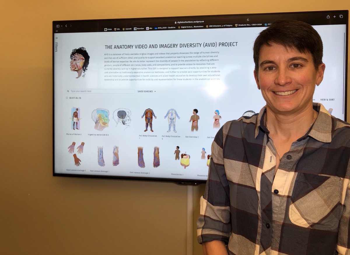The Anatomy Video and Imagery Diversity Project, co-led by #UCalgaryMed's Dr. Heather Jamniczky, PhD, aims to improve inclusivity in anatomical teaching by making anatomy education and illustrations more representative of diverse populations. Read more: bit.ly/46xSAt2