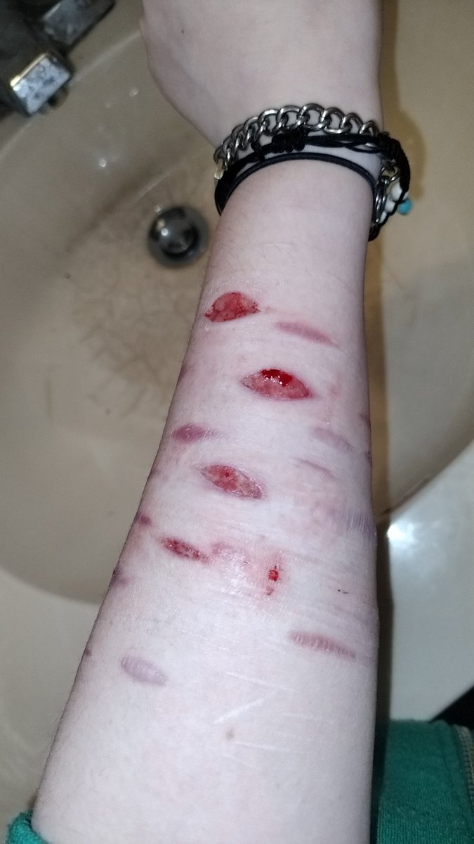Tw sh

Arm check. I've been cutting a lot but I haven't been posting them because I've felt that they're not good enough to be posted. Also unrelated, I have mad respect for thigh cutters. #shtwt