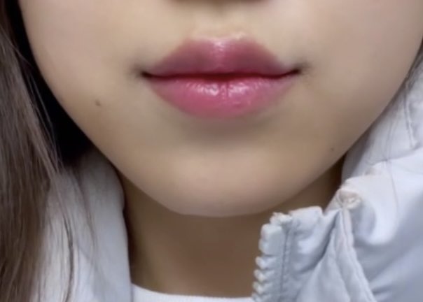 YOURCLINICJP's tweet photo. #クリスマス にも #正月 にも #ユアクリニック #yourclinic
365日オープンイベント

#しわボト1000₩(釜山 江南 弘大 限定)
#ポテンツァ  顔全体 9.9万₩
眉毛 #アートメイク  9.9万₩
#リジュランヒーラー 2cc 14.9万₩
#唇+口角 無制限 8.9万₩

リツイート&amp;フォローしておくと、12月以降も適用可能 https://t.co/JspWn56h6r