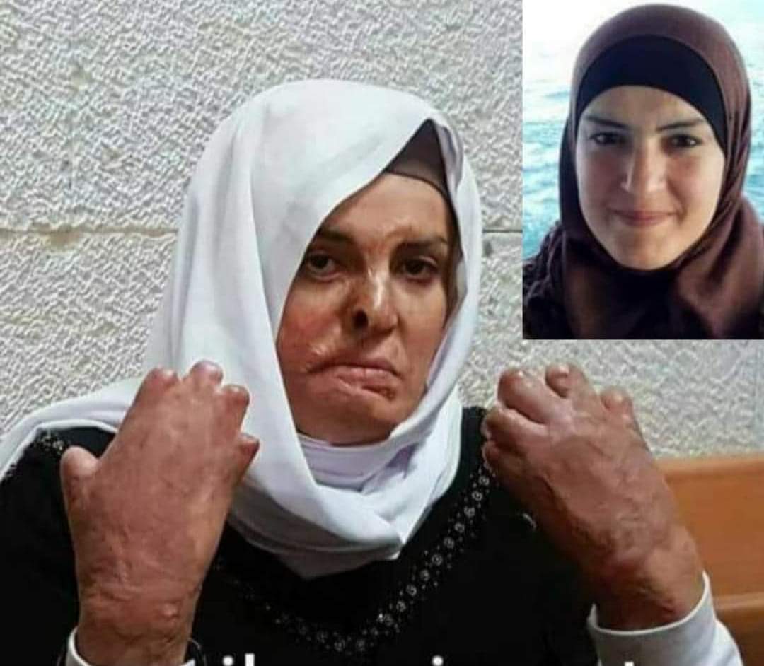 Isra Ja'abees foi sequestrada pela polícia terrorista de Israel, torturada, estuprada, ficou anos presa e foi devolvida assim pra sua casa.

 Israel por muitos anos usou ESTUPROS EM MASSA como arma de guerra e nunca foram chamados de terroristas. 

Enquanto isso os reféns dos