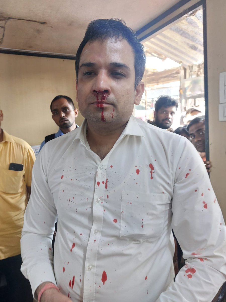 #MumbaiTerrorAttack  #ArrestHer
Rahul  Sharma who is working as a TC with Western Railway and at present is posted at Borivali Station, Mumbai dared to stop a Girl who was travelling without ticket. In return the Girl and her Goons did this to Rahul. GRP present there not able to