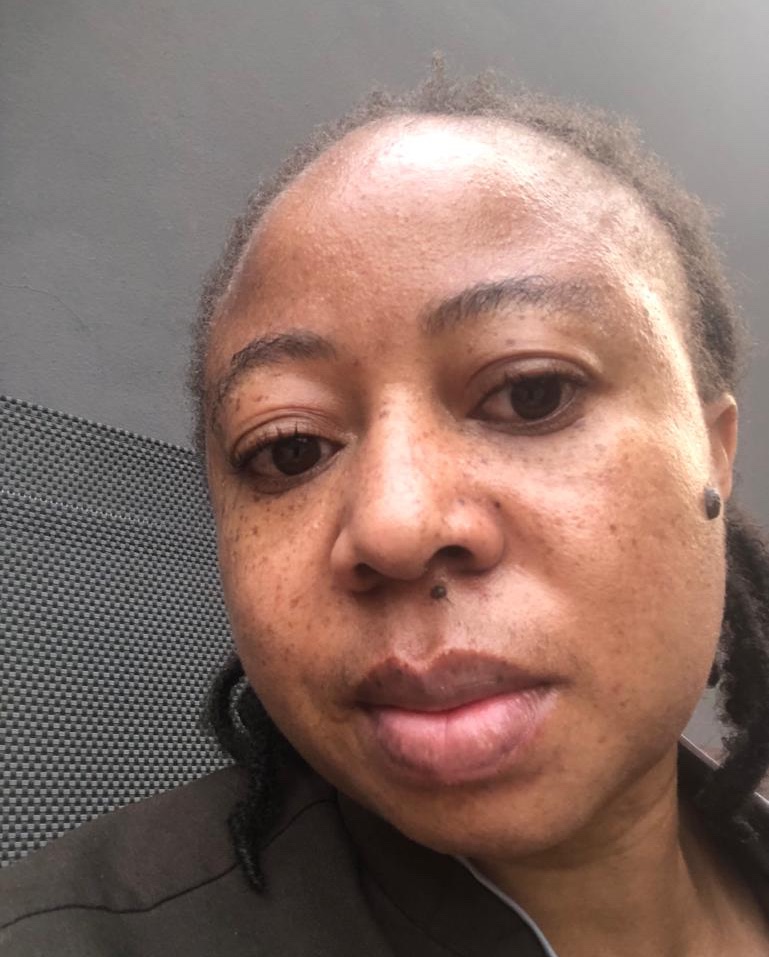 Sanaabeautyltd's tweet photo. Witness this radiant 'before' to 'after.' transformation from using our morning Dee serum
Secure yours via our website at the Black Friday price of N10,000 before it's gone!
#SanaaBeauty #LastDayMagic #SanaaGlow https://t.co/WsLGekSheP