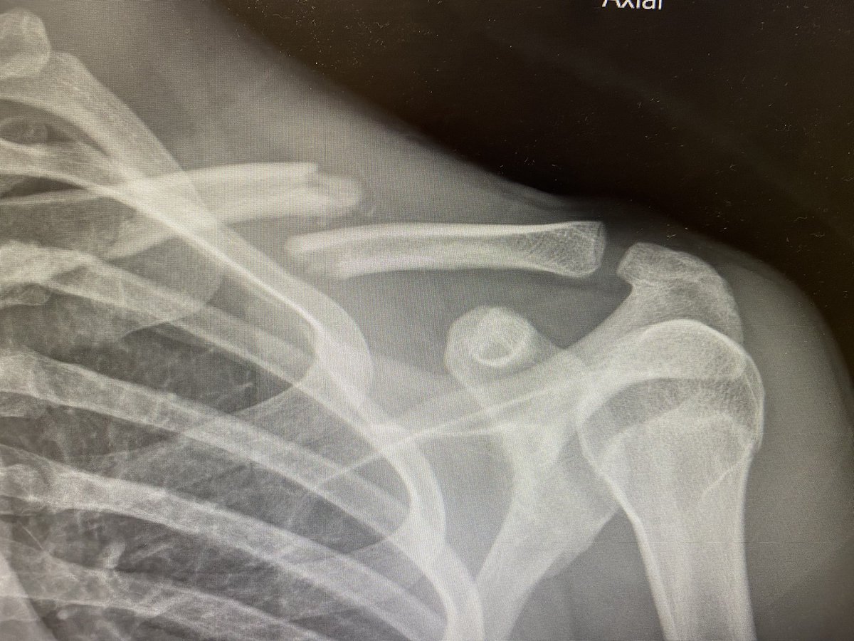 Obviously, not the way we wanted the season to end. I’ll be back healthier than I was, stronger than i was, and I can assure you that I will be back. God has a plan for everybody, and this is part of his plan for me. For now, #7 out.💙🤍