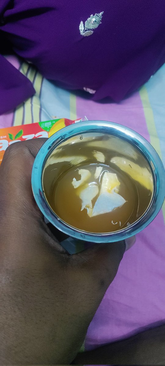 deenstyle2's tweet photo. @CocaColaCo @fssaiindia @jagograhakjago @CMOTamilnadu Complaint, I've found white fungal, slimy or don't know what exactly was, pic attached, found in Maaza 10 rs. Pack today. My children had few sips. Serious matter of mistrust &amp; lethal to lives of consumers. @MaazaIndia https://t.co/ORtmjziSuP