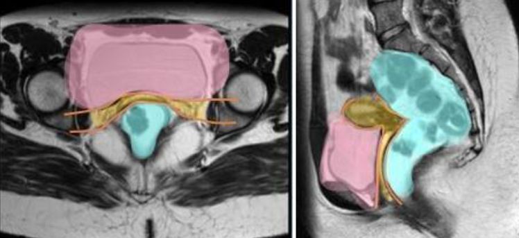 SERAM - Sociedad Española de Radiología Médica tweet media