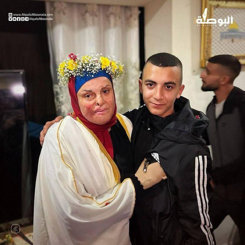 The injured Palestinian detainee Israa Ja’abis embraces her son after being released from occupation jails. #16thOctoberGroup #IsraelIsATerrorist