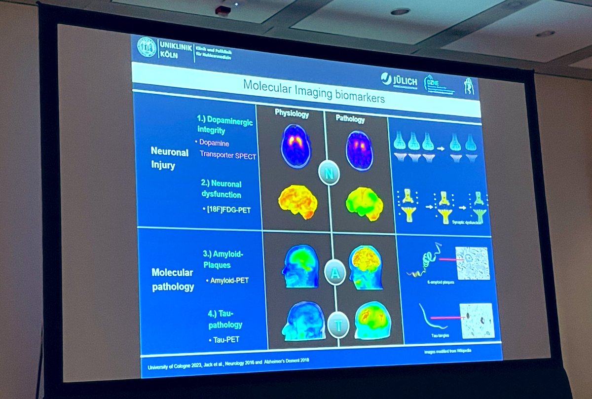 Great Molecular imaging neuro session @RSNA #RSNA2023 opening minds #Molecularimaging #Alzheimers #Memory-movement disorder