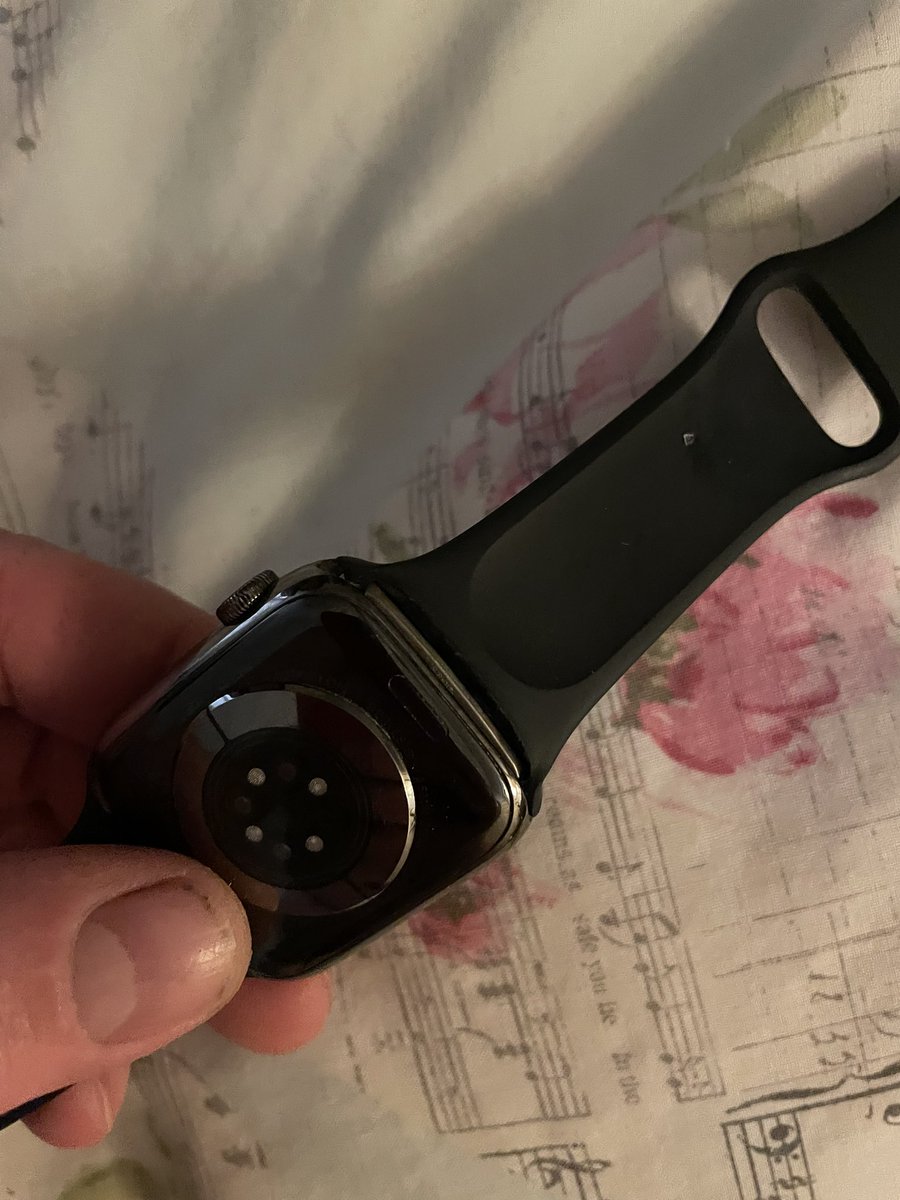 Pipknit's tweet photo. @Apple My watch strap is coming away from the watch itself. Is this normal? It’s 6 months old https://t.co/OPWD2XMNHM