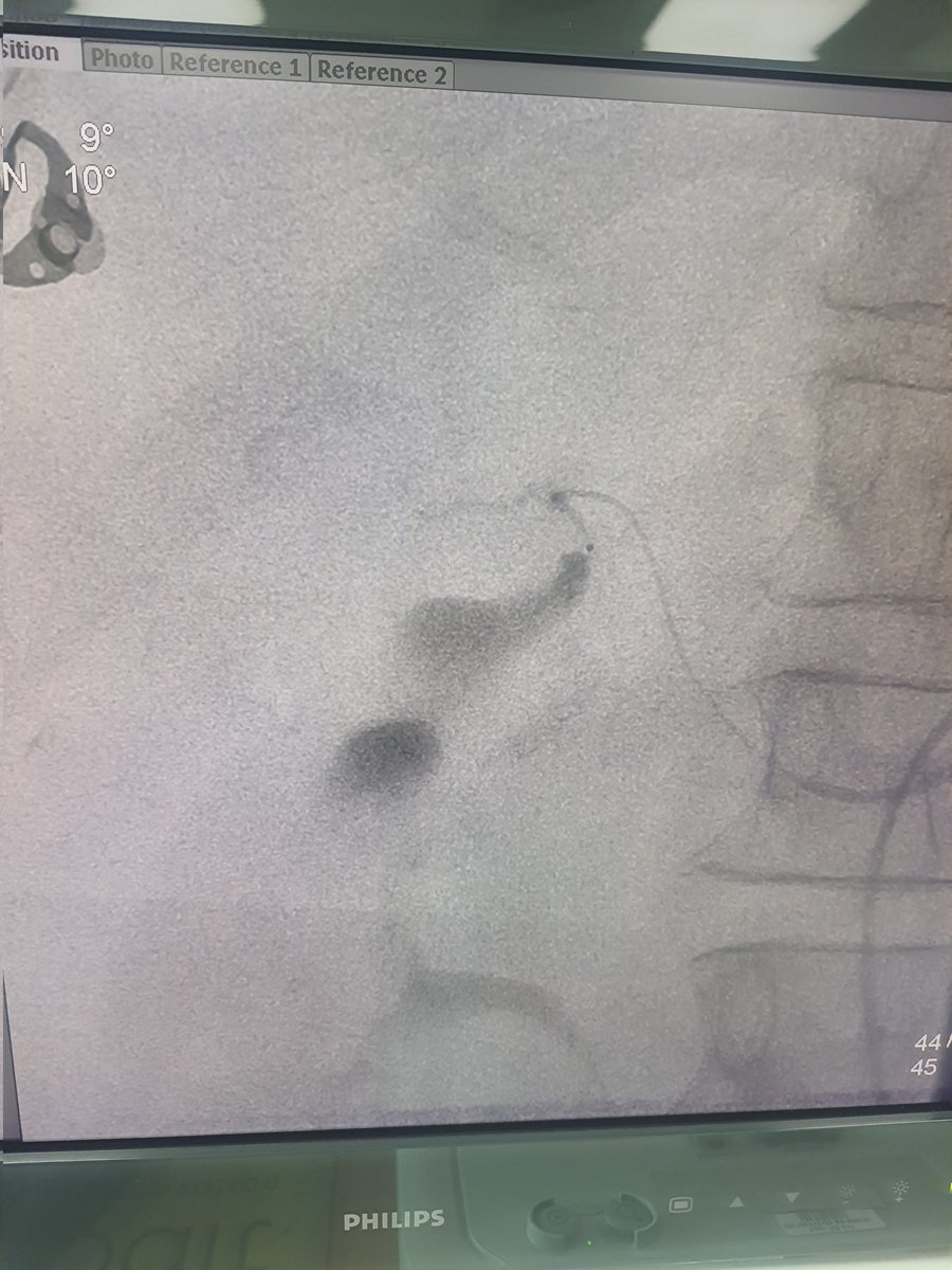 Dr Saurabh kumar Interventional radiologist tweet media
