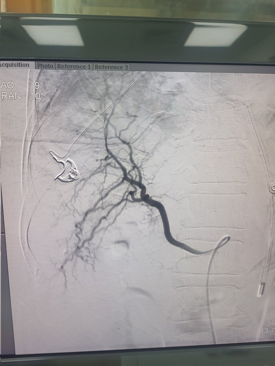 Dr Saurabh kumar Interventional radiologist tweet media